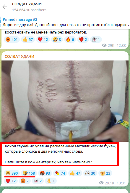 Russian Fascism | Російський Фашизм | Российский Фашизм|Z-канал «СОЛДАТ УДАЧИ» одобряет пытки украинского военнопленного (июнь 2025)